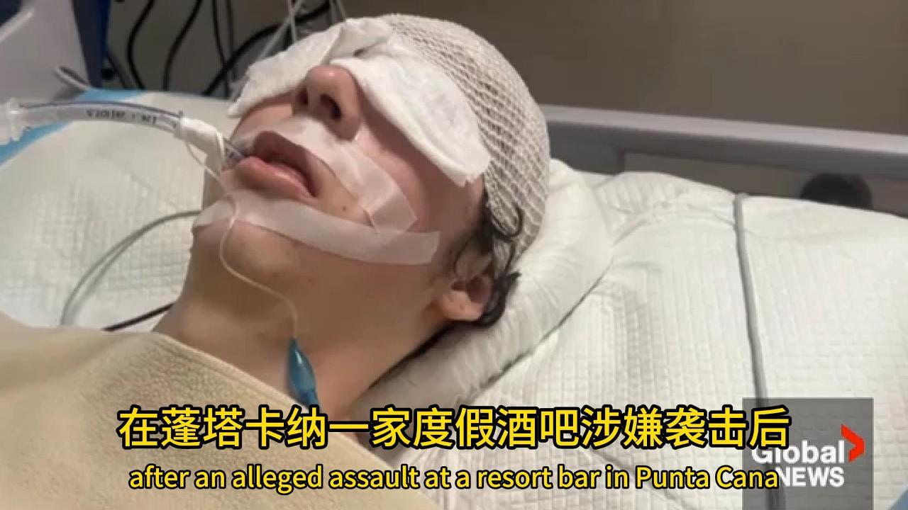  埃德蒙顿一名少年在多米尼加共和国涉嫌遭遇袭击受重伤 